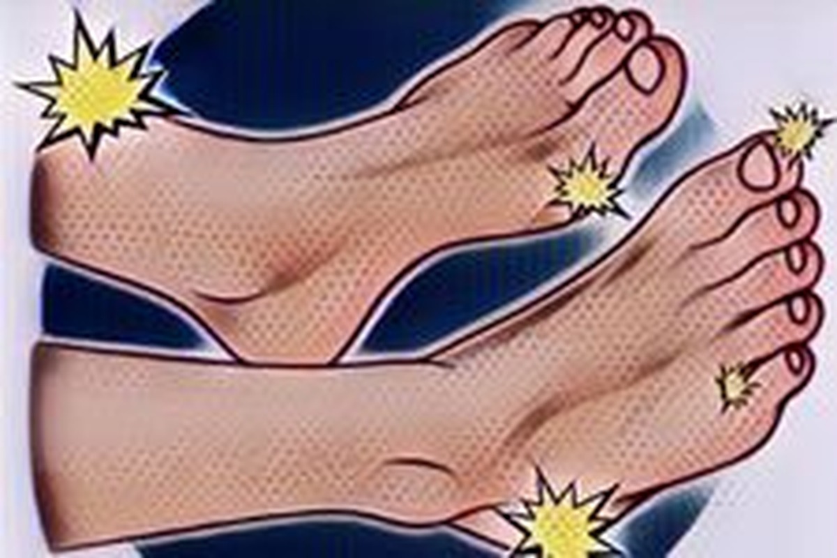 Illustrazione in stile pop art di due piedi con scintille gialle nei punti sensibili